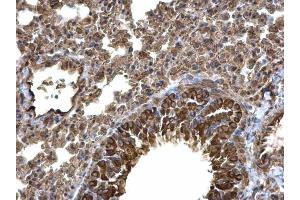 IHC-P Image Laminin alpha 4 antibody [C3], C-term detects Laminin alpha 4 protein at cytoplasm on mouse lung by immunohistochemical analysis.