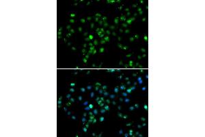 Immunofluorescence analysis of MCF-7 cells using RBBP6 antibody (ABIN5974190). (RBBP6 抗体)