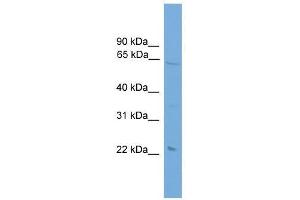 Western Blot showing EHD1 antibody used at a concentration of 1-2 ug/ml to detect its target protein.