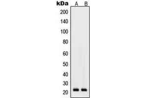Western blot analysis of RhoD expression in K562 (A), Raw264. (RHOD 抗体  (Center))