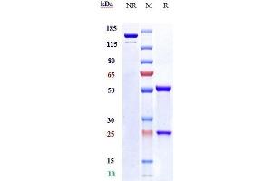 Anti-NRP1 / VEGF165R / CD304 Reference Antibody (vesencumab) on SDS-PAGE under reducing (R) condition. (Recombinant NRP1 (Vesencumab Biosimilar) 抗体)