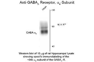 Western Blot of Anti-GABA(A) Receptor alpha 4 (Rabbit) Antibody - 612-401-D47 Western Blot of Anti-GABA(A) Receptor alpha 4 (Rabbit) Antibody.