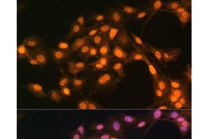 Immunofluorescence analysis of C6 cells using Snail Polyclonal Antibody at dilution of 1:100. (SNAIL 抗体)