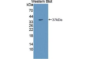 Western blot analysis of the recombinant protein. (CA8 抗体  (AA 1-290))