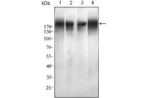 Western blot analysis using EGFR mutant antibody against SPC-A-1 (1), A549 (2), HepG2 (3) and MCF-7 (4) cell lysate. (EGFR Mutant (AA 693-893), (Mutant) 抗体)