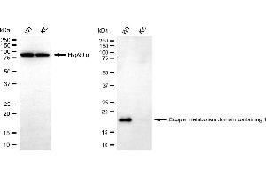 Western blotting analysis using copper metabolism domain containing 1 antibody (ABIN7798154). (COMMD1 抗体)
