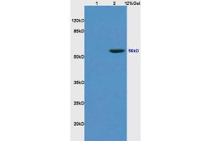 L1 rat kidney lysates L2 human colon carcinoma lysates probed with Anti KLF4 Polyclonal Antibody, Unconjugated (ABIN737121) at 1:200 overnight at 4 °C. (KLF2/4 抗体  (AA 415-513))
