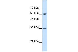 WB Suggested Anti-STIP1 Antibody Titration:  1. (STIP1 抗体  (N-Term))