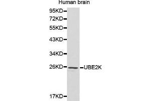 Western Blotting (WB) image for anti-Ubiquitin-Conjugating Enzyme E2K (UBE2K) (AA 1-100) antibody (ABIN6215017) (UBE2K 抗体  (AA 1-100))