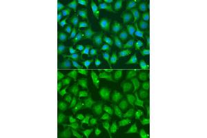 Immunofluorescence analysis of A549 cells using XRCC2 antibody. (XRCC2 抗体)
