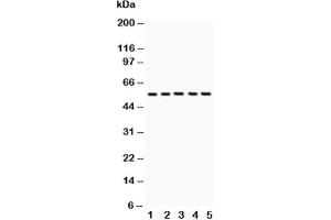 Western blot testing of GLUT4 antibody and Lane 1:  rat heart;  2: rat skeletal muscle;  3: mouse heart;  4: mouse skeletal muscle;  5: human HeLa lysate (GLUT4 抗体  (AA 491-509))
