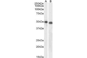 ABIN5539626 (1µg/ml) staining of Jurkat (A) and K562 (B) lysates (35µg protein in RIPA buffer). (DPF2 抗体  (AA 245-259))