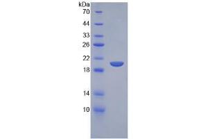 SDS-PAGE analysis of Mouse SLPI Protein.