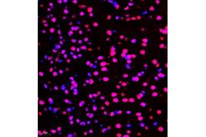 Immunofluorescence of paraffin embedded mouse brain using smad62024 (ABIN7075629) at dilution of 1:1000 (400x lens) (SMAD6 抗体)