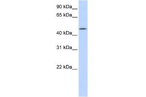 WB Suggested Anti-C20orf160 Antibody Titration: 0. (C20orf160 抗体  (N-Term))