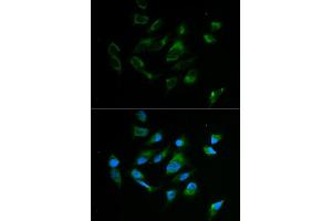 Immunofluorescence analysis of MCF7 cell using TYR antibody.