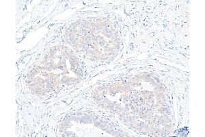 Immunohistochemistry (IHC) image for anti-Ubiquitin Protein Ligase E3 Component N-Recognin 4 (UBR4) (AA 5133-5183) antibody (ABIN7453830) (UBR4 抗体  (AA 5133-5183))