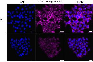 Immunocytochemical staining of HeLa cells using TANK binding kinase 1 antibody (ABIN7800506), 1:1,000), Top panel: wild-type (WT), Bottom panal: TANK binding kinase 1 shRNA knockdown (KD). (Recombinant TBK1 抗体)