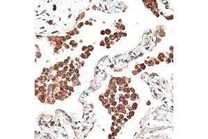 Immunohistochemistry of paraffin-embedded human lung using KTN1 antibody.