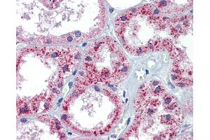 Immunohistochemistry (IHC) image for anti-Patched 1 (PTCH1) (C-Term) antibody (ABIN2773841) (Patched 1 抗体  (C-Term))