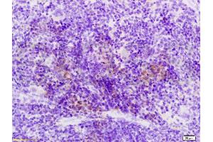 Immunohistochemistry (IHC) image for anti-Sema Domain, Immunoglobulin Domain (Ig), Short Basic Domain, Secreted, (Semaphorin) 3F (SEMA3F) (AA 651-754) antibody (ABIN737976)