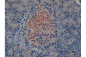 DAB staining on IHC-P; Samples: Rat Pancreas Tissue (Laminin alpha 1 抗体  (AA 41-230))