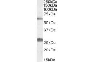 Image no. 1 for anti-Solute Carrier Family 47, Member 1 (SLC47A1) (Internal Region) antibody (ABIN375104) (SLC47A1 抗体  (Internal Region))
