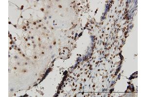 Immunoperoxidase of monoclonal antibody to SMAD7 on formalin-fixed paraffin-embedded human placenta. (SMAD7 抗体  (AA 160-260))