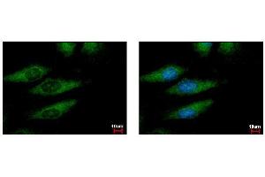 ICC/IF Image Iba1 antibody detects AIF1 protein at cytoplasm by immunofluorescent analysis.
