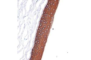 Immunohistochemistry of paraffin-embedded rat cornea using Cytokeratin 12 (KRT12) (KRT12) Rabbit mAb (ABIN7268087) at dilution of 1:100 (40x lens). (KRT12 抗体)