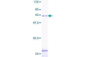 SMN2 Protein (AA 1-282) (GST tag)