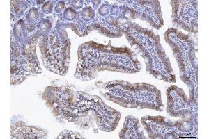 IHC analysis of TOX using anti-TOX antibody (ABIN7599443).