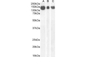Western Blot using anti-Amyloid beta antibody 6E10.