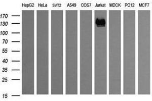 Image no. 2 for anti-CD163 (CD163) antibody (ABIN1497176) (CD163 抗体)