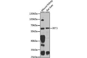Western blot analysis of extracts of various cell lines, using IFIT3 antibody (ABIN1680389, ABIN3018293, ABIN3018295 and ABIN6220427) at 1:1000 dilution. (IFIT3 抗体  (AA 128-331))