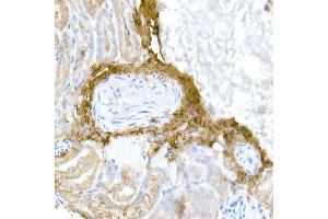 Immunohistochemistry (IHC) image for anti-Collagen, Type I, alpha 1 (COL1A1) (AA 100-200) antibody (ABIN6138837)