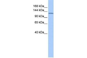 NUP155 antibody used at 1 ug/ml to detect target protein. (NUP155 抗体  (N-Term))