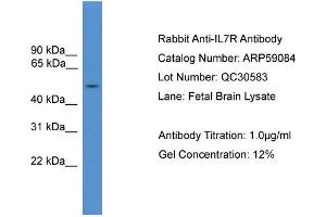WB Suggested Anti-IL7R  Antibody Titration: 0. (IL7R 抗体  (Middle Region))
