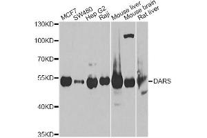 Western blot analysis of extracts of various cell lines, using DARS Antibody. (DARS 抗体)