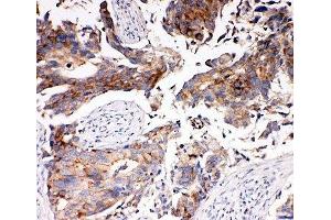 Immunohistochemistry (IHC) image for anti-Solute Carrier Family 16 (Monocarboxylic Acid Transporters), Member 4 (SLC16A4) (N-Term) antibody (ABIN3032674)