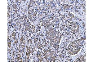 IHC analysis of SUCLG2 using anti-SUCLG2 antibody (ABIN7601694).