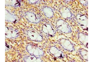 Immunohistochemistry of paraffin-embedded human colon tissue using ABIN7156649 at dilution of 1:100 (GBP1 抗体  (AA 383-592))