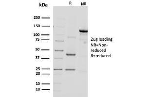 SDS-PAGE Analysis Purified HER-2 Mouse Monoclonal Antibody (ERBB2/3092). (ErbB2/Her2 抗体  (AA 311-462))