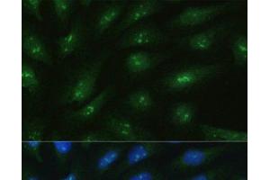 Immunofluorescence (IF) image for anti-RAD50 Homolog (S. Cerevisiae) (RAD50) antibody (ABIN7010313)