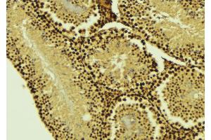 ABIN6274505 at 1/100 staining Mouse testis tissue by IHC-P.