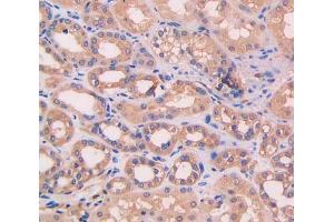 IHC-P analysis of kidney tissue, with DAB staining. (Complement Factor B 抗体  (AA 35-160))