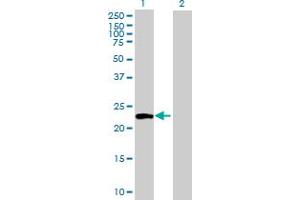 Western Blot analysis of ATG12 expression in transfected 293T cell line by ATG12 MaxPab polyclonal antibody. (ATG12 抗体  (AA 1-187))