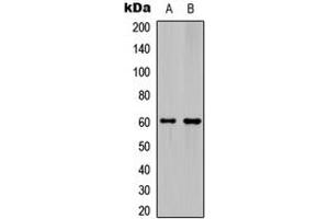 Western blot analysis of Ephrin B1/2 expression in HeLa (A), mouse hippocampus (B) whole cell lysates. (Ephrin B1 抗体  (C-Term))