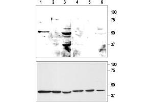 Western blot analysis of KCNK9 in rat cerebellum (lanes 1, 4), human mammary gland MCF-10A (lanes 2, 5) and MCF-7 (lanes 3, 6) cell lysates (upper panel):  - 1-3. (KCNK9 抗体  (Extracellular, P1 Loop))