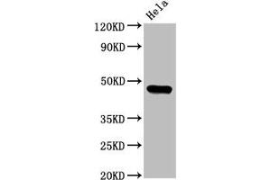Western Blot Positive WB detected in: Hela whole cell lysate All lanes: CSNK1E antibody at 3.